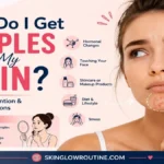 why do i get pimples on my chin