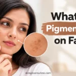 What Is Pigmentation on Face?